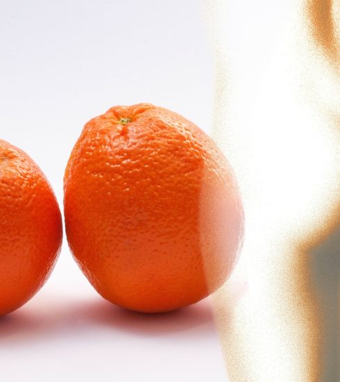 Orange Peel Cellulite Orange  - stux / Pixabay